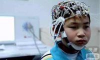 孩子患癫痫家长应如何护理