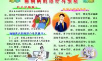 癫痫有哪些发病机制