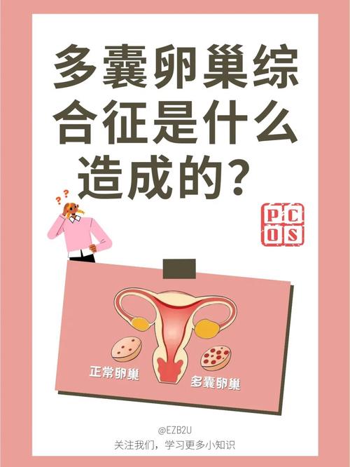 什么原因造成多囊
