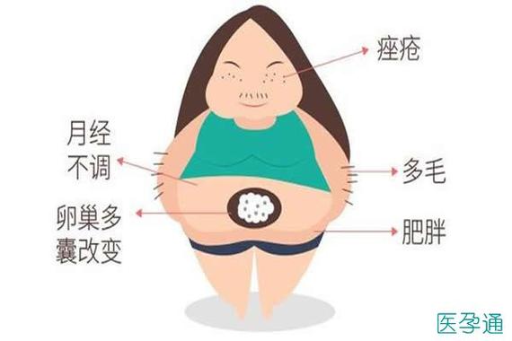 多囊卵巢怎么形成的，有哪些危害？