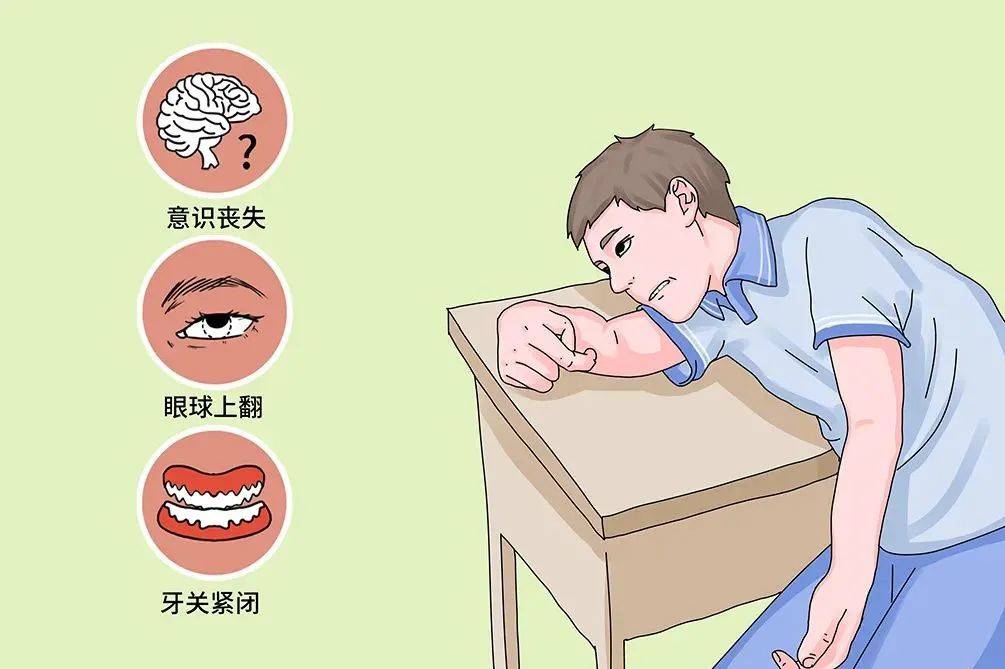 癫痫的不良影响具体有哪些