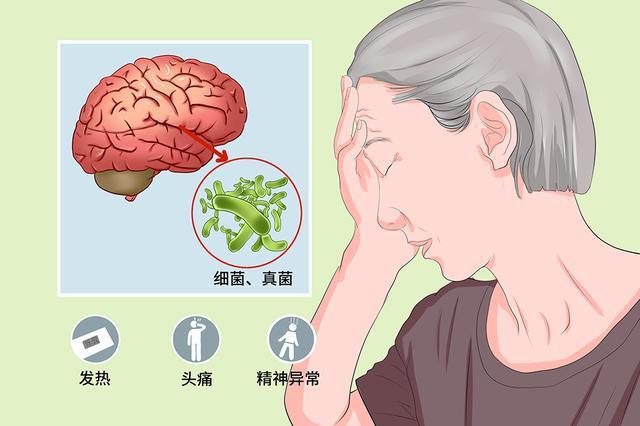癫痫病的并发症会有哪些