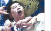 癫痫发作症状如何处理？