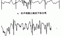 脑电图能检查出什么疾病